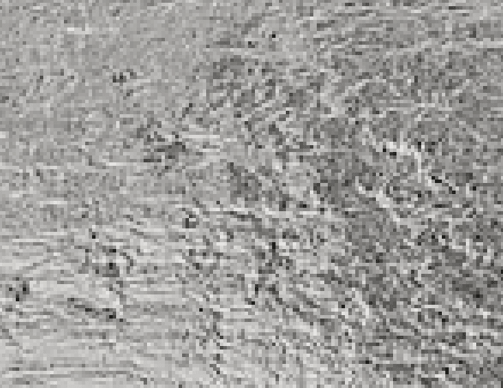 AL Foil (알루미늄 포일)